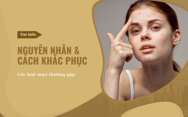 Nguyên nhân và cách khắc phục các loại mụn trên mặt