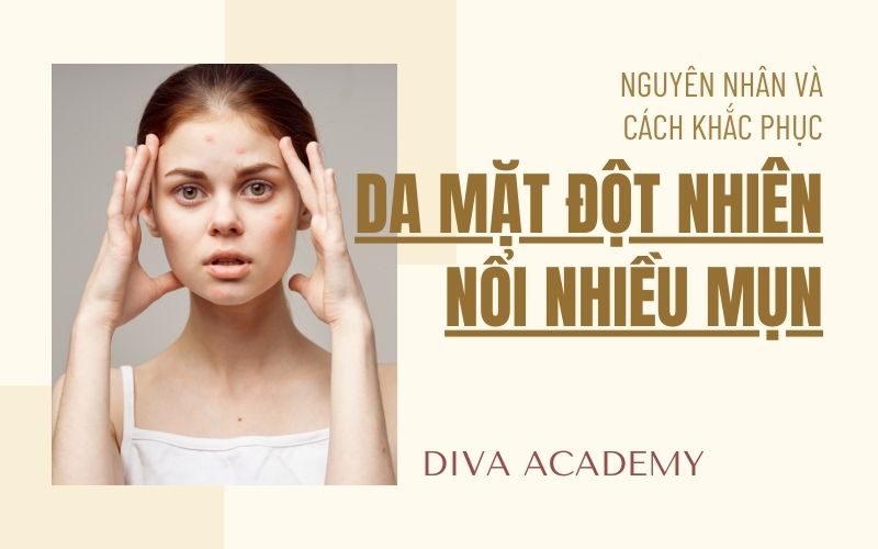 Da mặt đột nhiên nổi nhiều mụn - Nguyên nhân và cách khắc phục