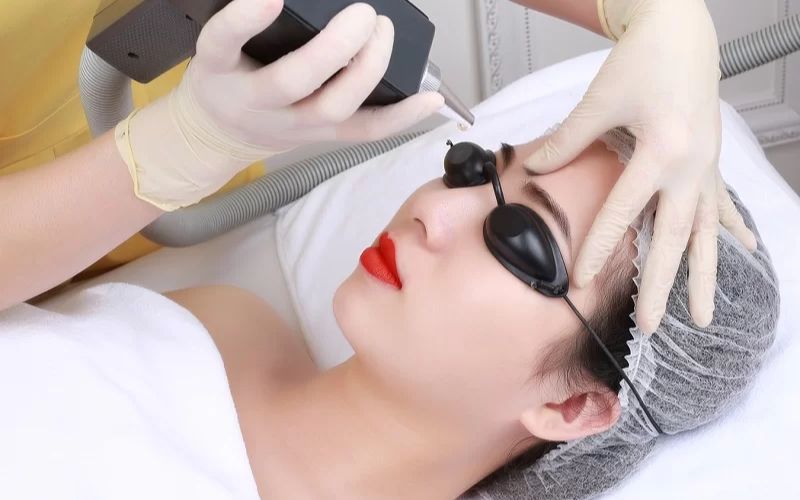 Khóa học phun thêu chân mày 3D đào tạo các kỹ thuật xóa xăm bằng laser hiện đại 